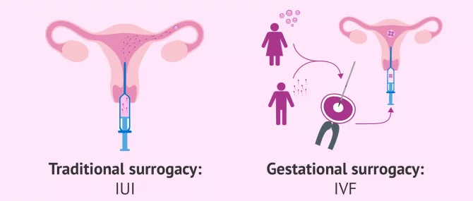 Endometrial Preparation Process